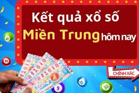 dự đoán kết quả xổ số miền trung